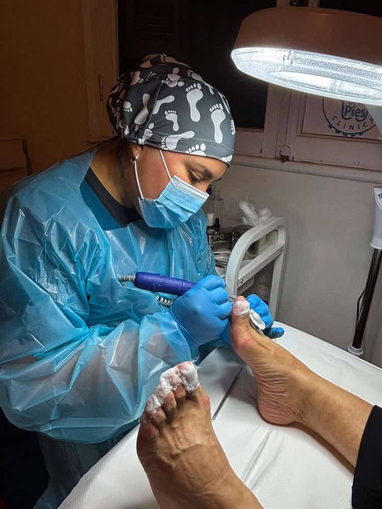 Carolina Cepeda realizando fresado técnico de uñas con micromotor durante una atención podológica