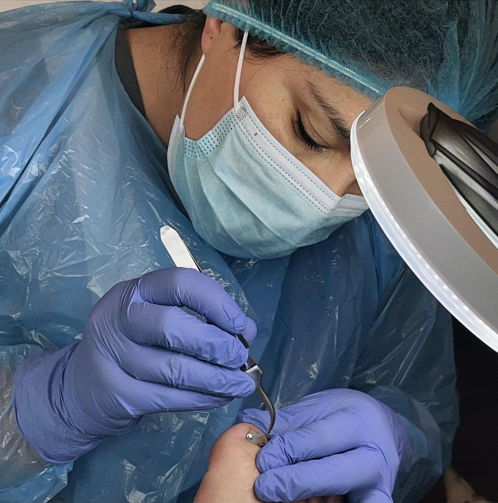 Detalle del trabajo con instrumental podológico esterilizado y lupa de aumento